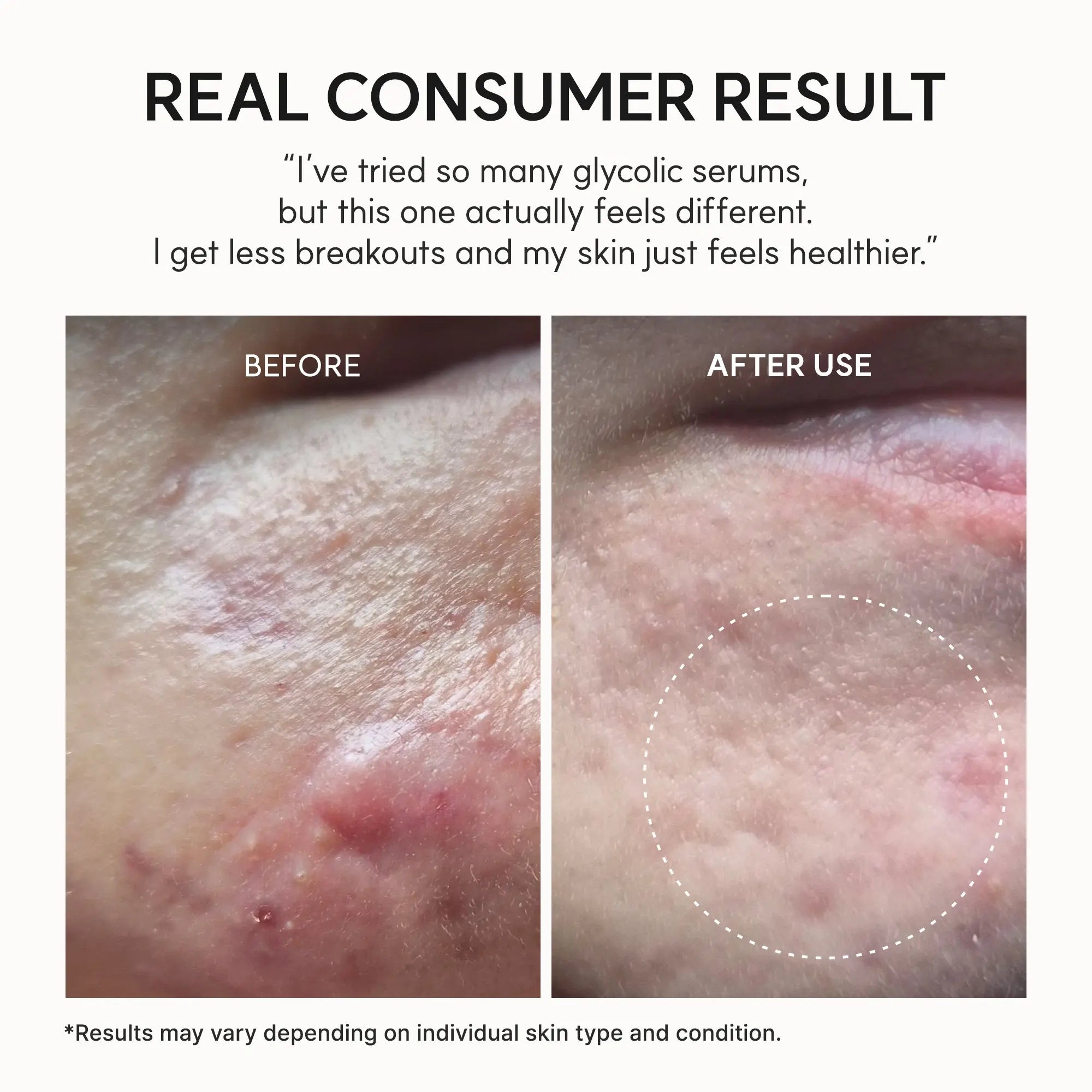 ARENCIA Eraser Shot Glycolic Acid Booster in 30ml bottle, clear liquid skincare product for exfoliation and skin renewal.