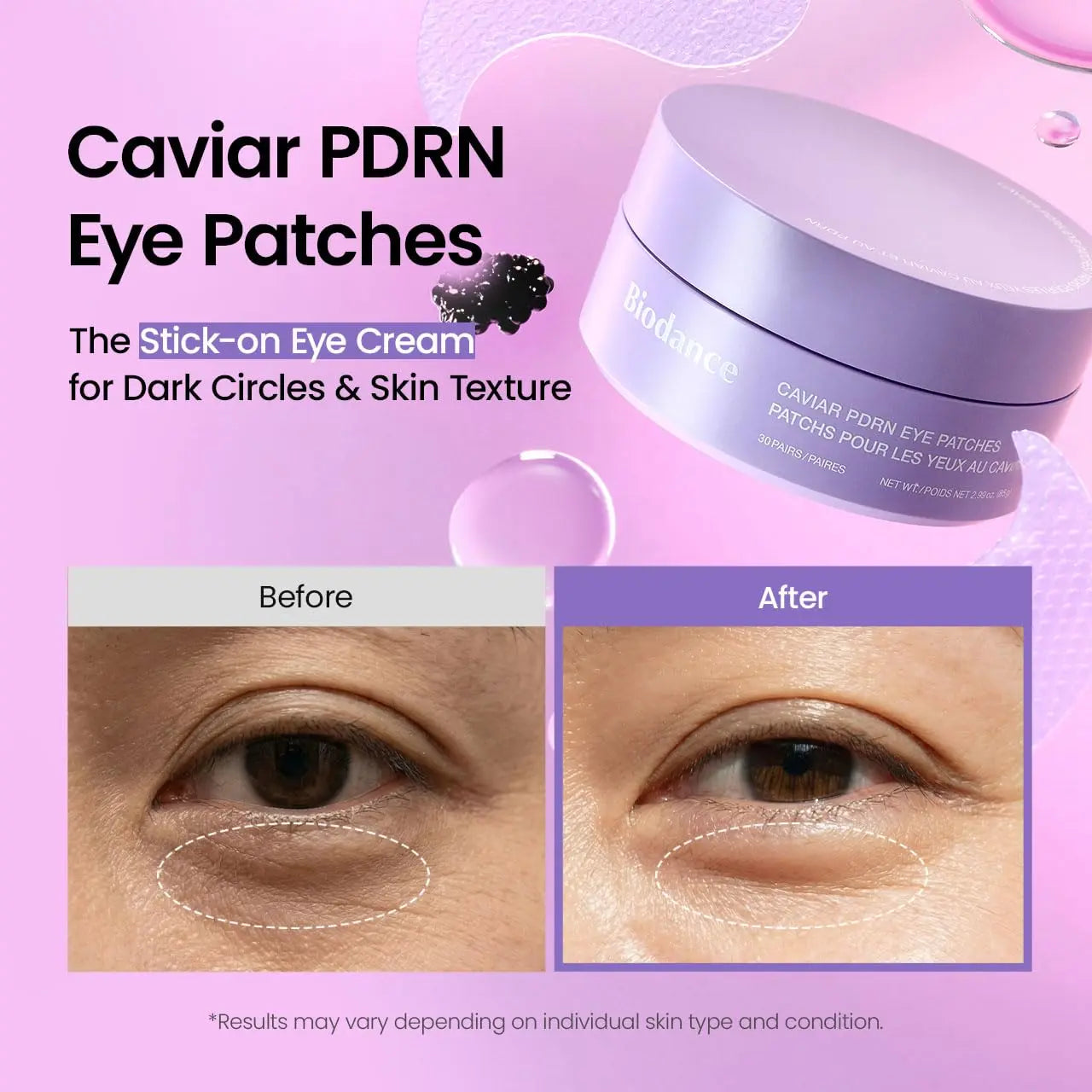 BIODANCE Caviar PDRN Eye Patches 55g BIODANCE JOLIE'S