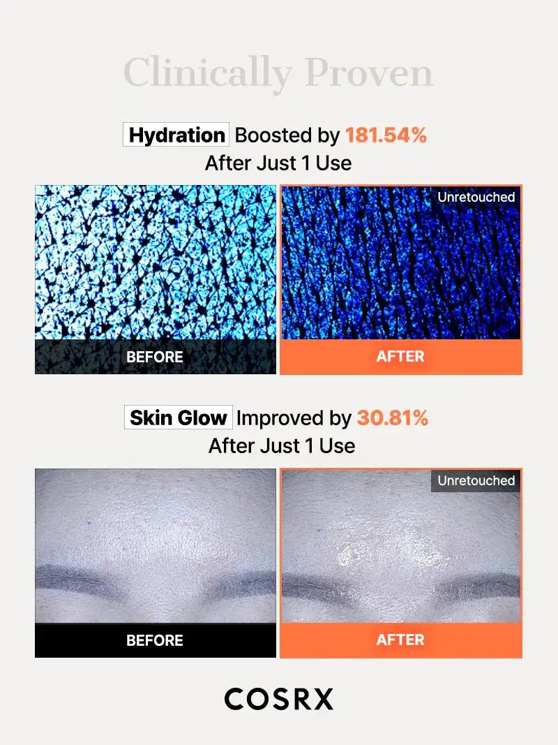 COSRX 5 PDRN Hyaluronic Acid Vital Hydrating Hydrogel Mask COSRX JOLIE'S