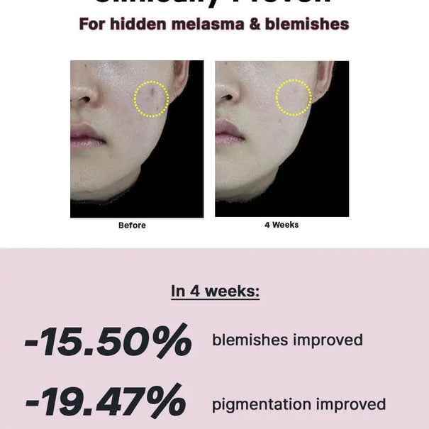COSRX The Niacinamide 15 Serum 20 ml - JOLIE'S