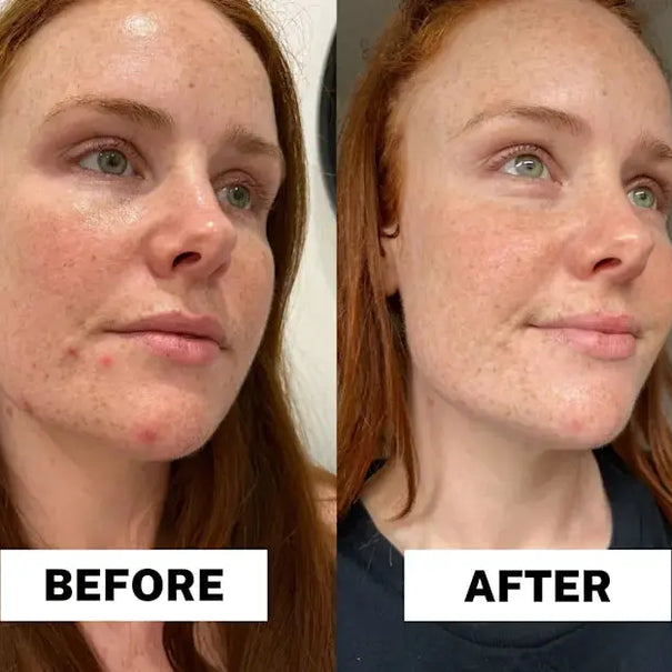 Dr.Melaxin Radiant Glow Duo Peeling Kit - DOKAN