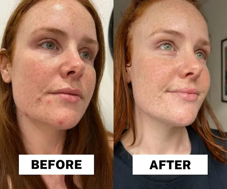 Dr.Melaxin Radiant Glow Duo Peeling Kit - DOKAN