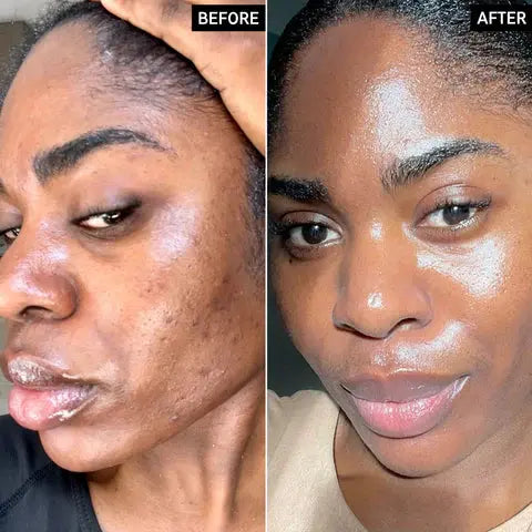 Dr.Melaxin Radiant Glow Duo Peeling Kit - DOKAN