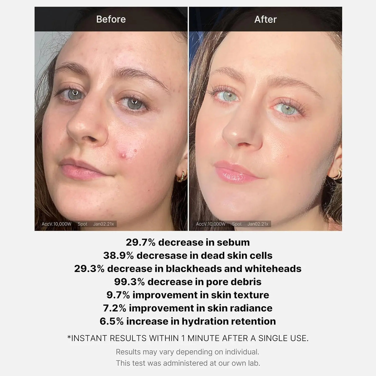 MEDICUBE Red Acne Succinic Acid Peel Serum Medicube JOLIE'S