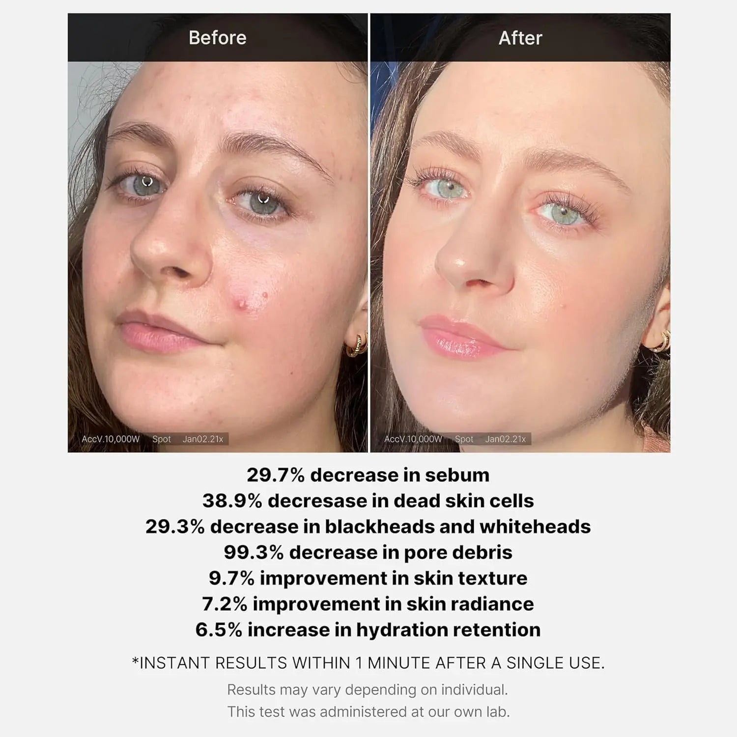 MEDICUBE Red Acne Succinic Acid Peel Serum Medicube JOLIE'S