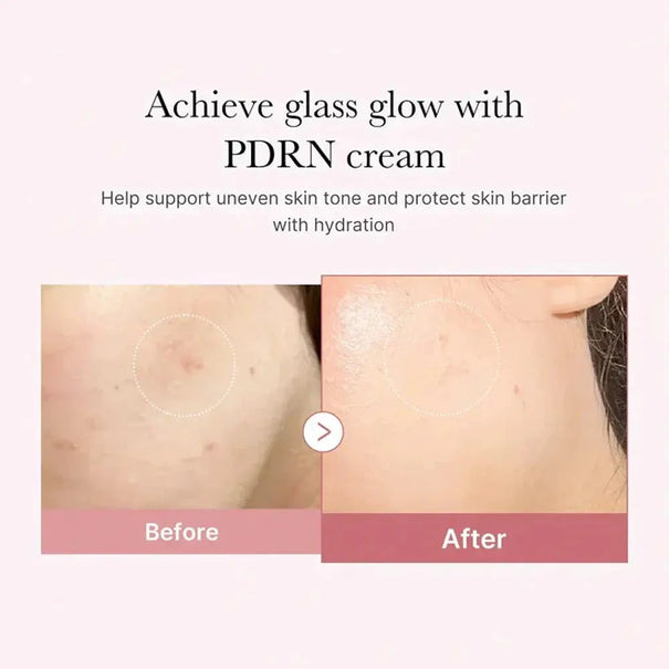 Medicube PDRN Pink Hyaluronic Moisturizing Cream (50ml) Medicube
