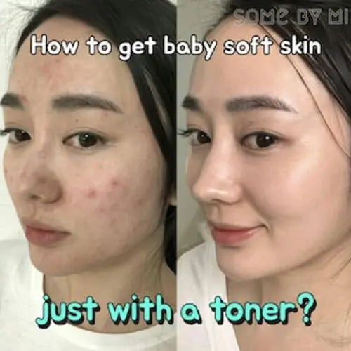 DOKAN SOME BY ME AHA BHA PHA 30 Days Miracle Toner 150ml SOME BY MI